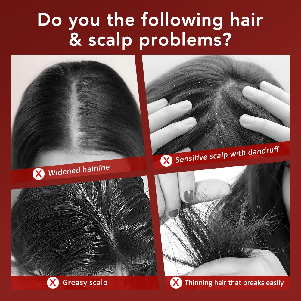 Red Light Scalp Massage Comb